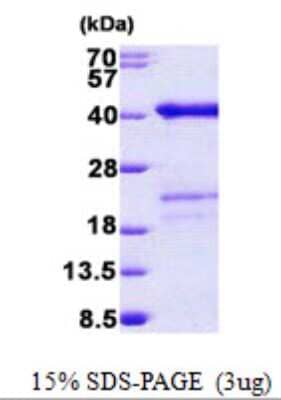 SDS-PAGE: Recombinant Human SURF2 His Protein [NBP2-22651]