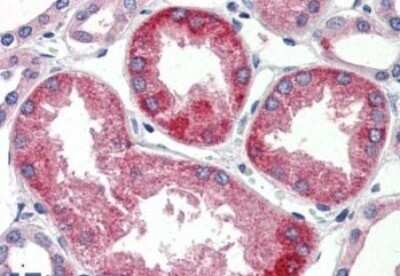 Immunohistochemistry-Paraffin: SURF4 Antibody - BSA Free [NBP1-44374]