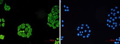 Immunocytochemistry/ Immunofluorescence: SURF4 Antibody (S07-1F1) [NBP3-19808]