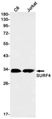 Western Blot: SURF4 Antibody (S07-1F1) [NBP3-19808]