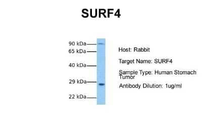 Western Blot: SURF4 Antibody [NBP1-59452]