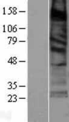 Western Blot: SURF4 Overexpression Lysate [NBP2-04408]