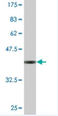 Western Blot: SURF5 Antibody (3A9) [H00006837-M01]