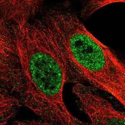 Immunocytochemistry/ Immunofluorescence: SURF5 Antibody [NBP2-56128]