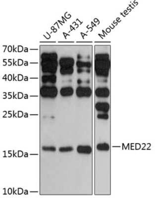 Western Blot: SURF5 AntibodyAzide and BSA Free [NBP2-93744]