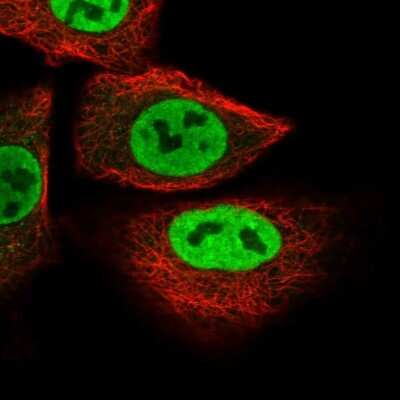 Immunocytochemistry/ Immunofluorescence: SUSD1 Antibody [NBP2-13401]