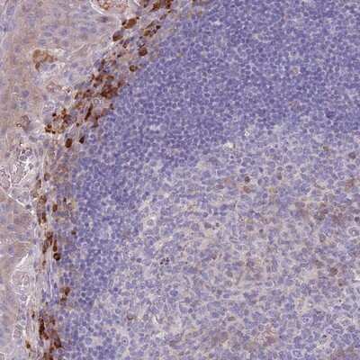 Immunohistochemistry-Paraffin: SUSD1 Antibody [NBP2-13401]