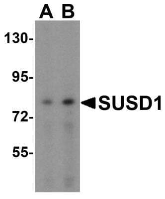 Western Blot: SUSD1 AntibodyBSA Free [NBP2-61129]