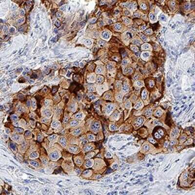 Immunohistochemistry: SUSD2 Antibody (1279C) - Azide and BSA Free [MAB90565]