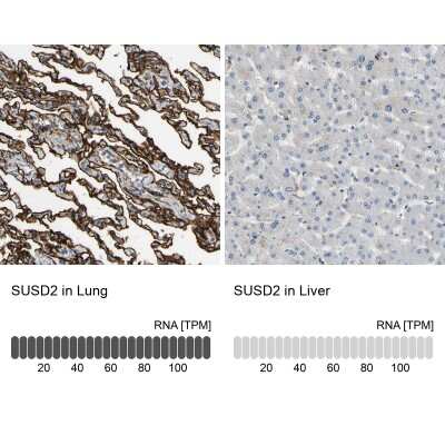 Immunohistochemistry-Paraffin: SUSD2 Antibody [NBP1-88589]