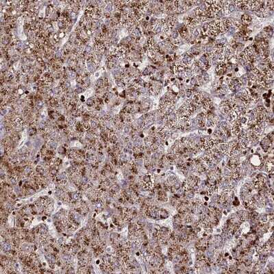 Immunohistochemistry-Paraffin: SUSD3 Antibody [NBP1-82723]