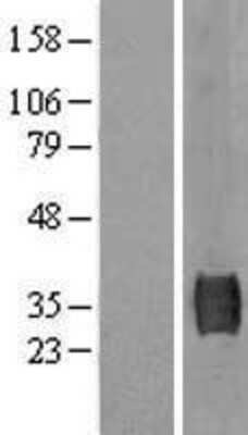 Western Blot: SUSD3 Overexpression Lysate [NBL1-16623]