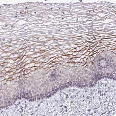 Immunohistochemistry-Paraffin: SUSD4 Antibody [NBP2-31711]