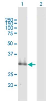 Western Blot: SUSD4 Antibody [H00055061-B01P]