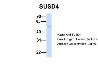 Western Blot: SUSD4 Antibody [NBP1-59974]