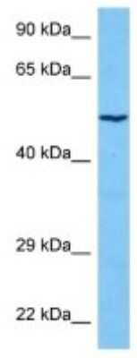 Western Blot: SUSD4 Antibody [NBP3-10174]