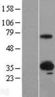 Western Blot: SUSD4 Overexpression Lysate [NBL1-16624]