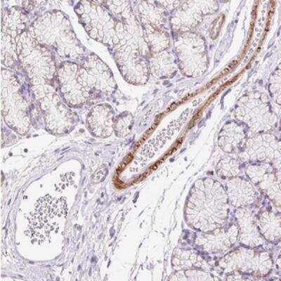 Immunohistochemistry-Paraffin: SUSD5 Antibody [NBP2-30803]