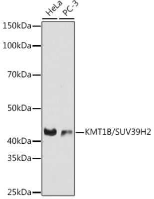 Western Blot: SUV39H2 Antibody (6L2D9) [NBP3-16258]