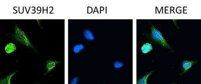 Immunocytochemistry: SUV39H2 Antibody [NB100-1140]