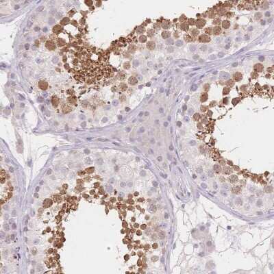 Immunohistochemistry-Paraffin: SUV39H2 Antibody [NBP2-38828]