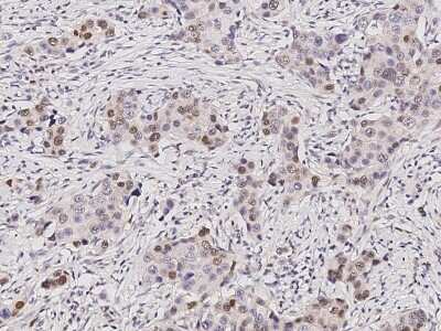 Immunohistochemistry-Paraffin: SUV39H2 Antibody [NBP2-98968]