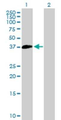 Western Blot: SUV39H2 Antibody [H00079723-B01P]