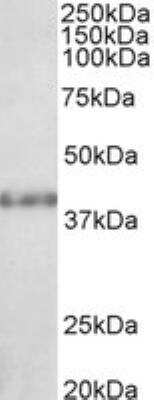 Western Blot: SUV39H2 Antibody [NB100-1140]