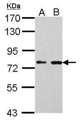 Western Blot: SUV3L1 Antibody (244) [NBP2-43565]