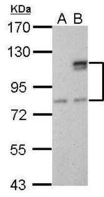 Western Blot: SUV3L1 Antibody (244) [NBP2-43565]