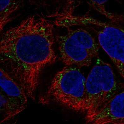 Immunocytochemistry/ Immunofluorescence: SUV3L1 Antibody [NBP2-34047]
