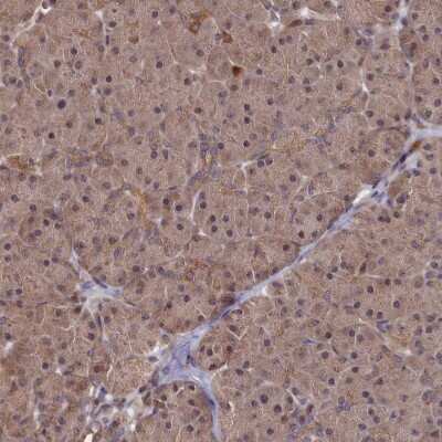 Immunohistochemistry-Paraffin: SUV3L1 Antibody [NBP1-80711]