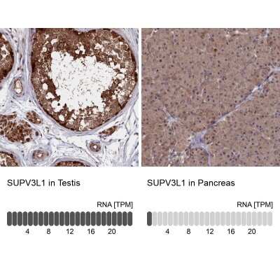 Immunohistochemistry-Paraffin: SUV3L1 Antibody [NBP1-80711]