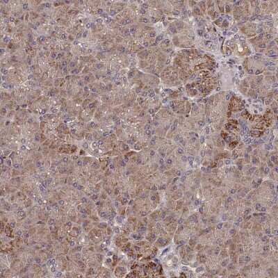 Immunohistochemistry-Paraffin: SUV3L1 Antibody [NBP2-34047]