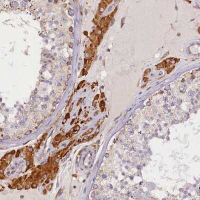 Immunohistochemistry-Paraffin: SUV3L1 Antibody [NBP2-34047]