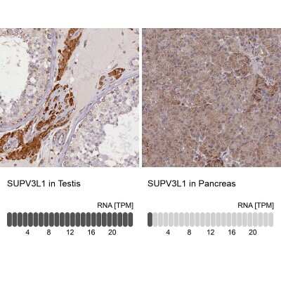 Immunohistochemistry-Paraffin: SUV3L1 Antibody [NBP2-34047]