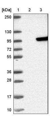 Western Blot: SUV3L1 Antibody [NBP1-80711]