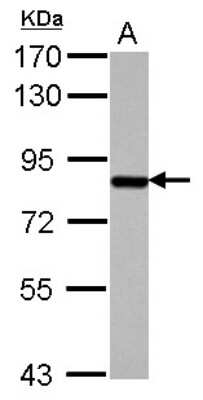 Western Blot: SUV3L1 Antibody [NBP2-20539]