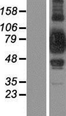 Western Blot: SUV3L1 Overexpression Lysate [NBP2-10874]