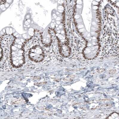 Immunohistochemistry-Paraffin: SUV420H2 Antibody [NBP2-30524]