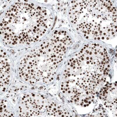 Immunohistochemistry-Paraffin: SUV420H2 Antibody [NBP2-30524]