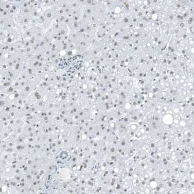 Immunohistochemistry-Paraffin: SUV420H2 Antibody [NBP2-30524]
