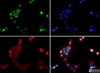 Immunocytochemistry/ Immunofluorescence: SUV420h1 Antibody - BSA Free [NBP1-97312]