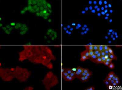 Immunocytochemistry/ Immunofluorescence: SUV420h1 Antibody - BSA Free [NBP1-97313]