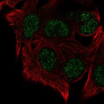 Immunocytochemistry/ Immunofluorescence: SUV420h1 Antibody [NBP2-57721]