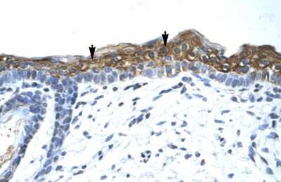 Immunohistochemistry: SUV420h1 Antibody [NBP1-78303]
