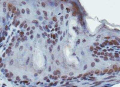 Immunohistochemistry: SUV420h1 Antibody - BSA Free [NBP1-97312]