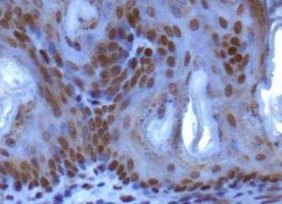 Immunohistochemistry: SUV420h1 Antibody - BSA Free [NBP1-97313]