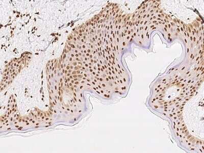 Immunohistochemistry-Paraffin: SUV420h1 Antibody [NBP2-99518]