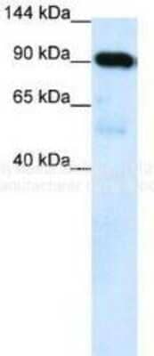 Western Blot: SUV420h1 Antibody [NBP1-78303]